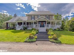 305 Bass Lake Sideroad East Side Road E Oro-Medonte, ON L0L 2E0