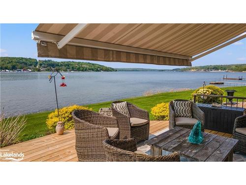 10-8 Beck Boulevard, Penetanguishene, ON - Outdoor With Body Of Water With Deck Patio Veranda With View With Exterior