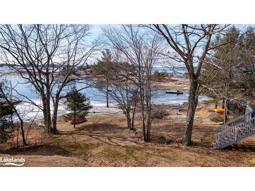3 Forsyth'S Road, Carling, ON - Outdoor With Body Of Water With View