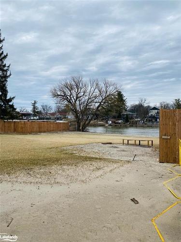 77, 79, 87 Mosley Street, Wasaga Beach, ON - Outdoor With View
