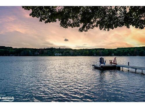180 Farlain Lake Road E, Tiny, ON - Outdoor With Body Of Water With View