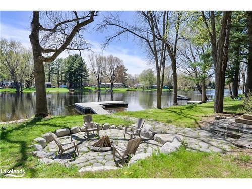 1036 Bagley Road, Gravenhurst, ON - Outdoor With Body Of Water With Backyard