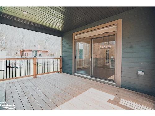 27 Albion Lane, Tiny, ON - Outdoor With Deck Patio Veranda With Exterior