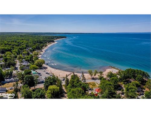 35 Arbor Road, Tiny, ON - Outdoor With Body Of Water With View