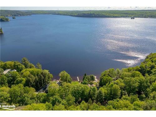 175 Rowanwood Lane, Utterson, ON - Outdoor With Body Of Water With View