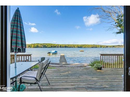 62 Farlain Lake Road E, Tiny, ON - Outdoor With Body Of Water With View