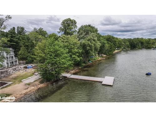 3305 Summerhill Way, Severn, ON - Outdoor With Body Of Water With View