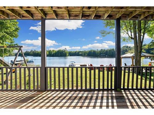 25 Fire Route 296, Trent Lakes, ON - Outdoor With Body Of Water With View