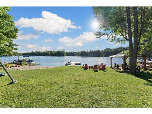 25 Fire Route 296, Trent Lakes, ON - Outdoor With Body Of Water With View