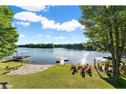 25 Fire Route 296, Trent Lakes, ON - Outdoor With Body Of Water With View