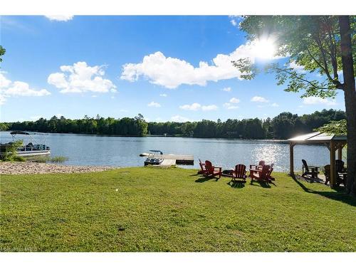 25 Fire Route 296, Trent Lakes, ON - Outdoor With Body Of Water With View